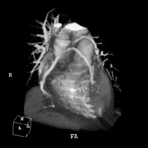 Cardiac imaging news