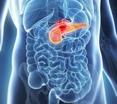 Elderly pancreatic cancer patients benefit from stereotactic body radiotherapy