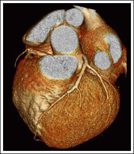 Cardiac imaging news 