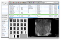 OsiriX Imaging Software